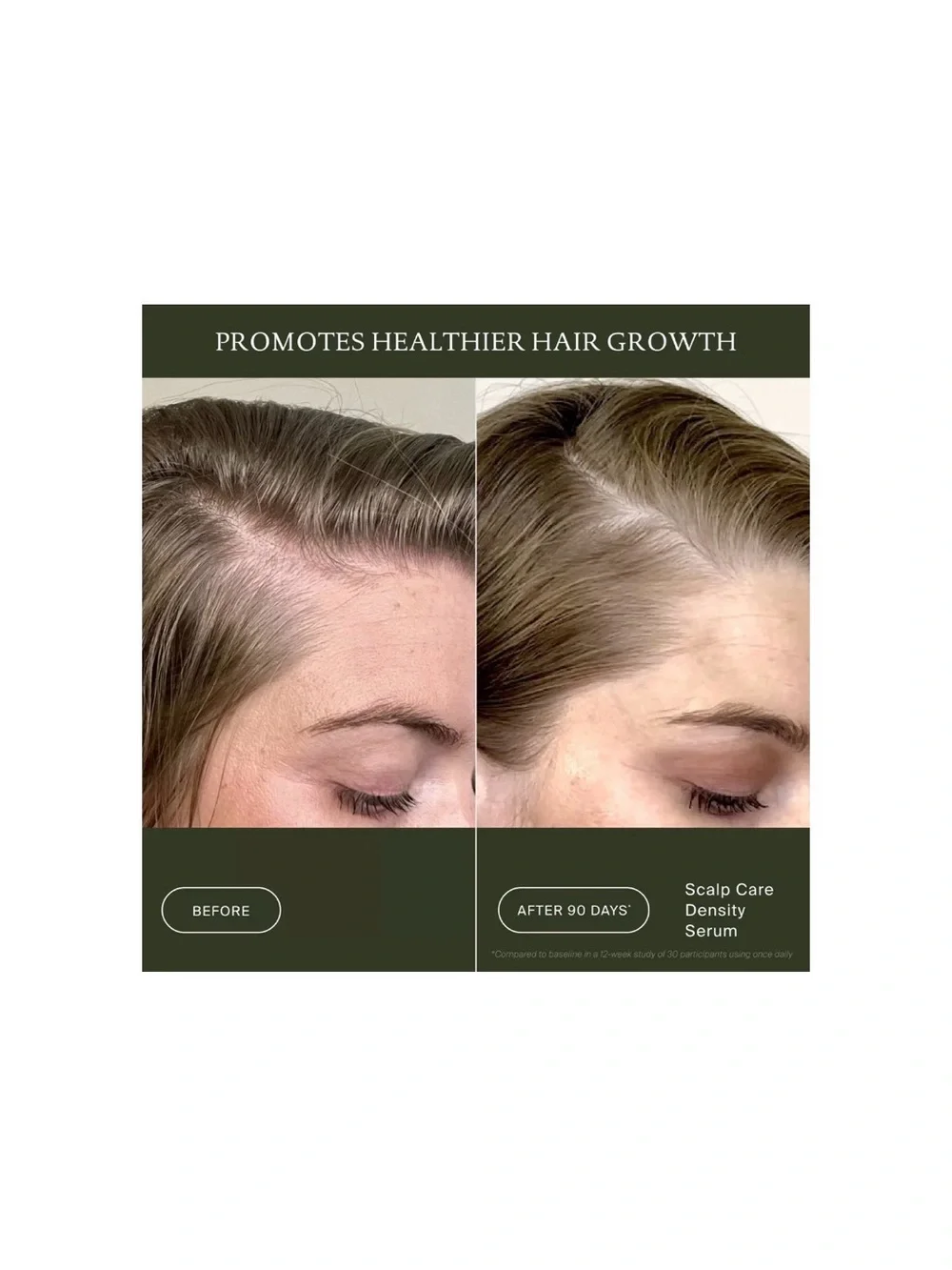 Living proof Scalp care density serum NEW originally $68